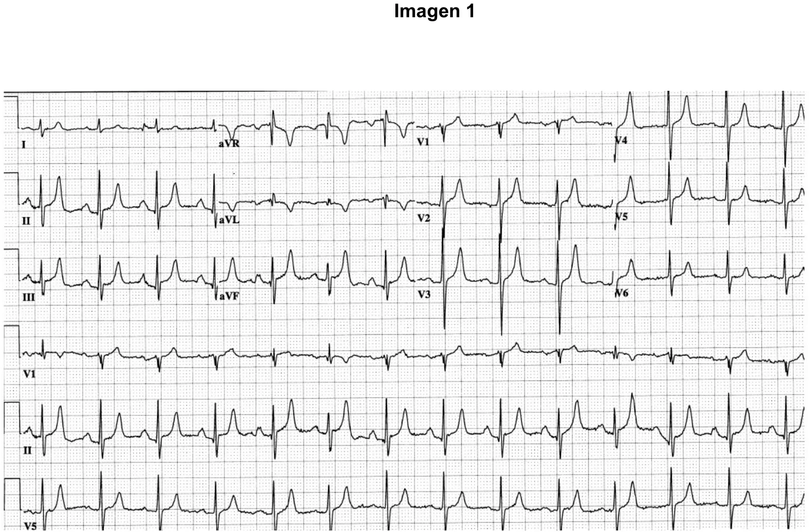Figura del cuadernillo oficial de imágenes del examen EIR 2023: electrocardiograma de 12 derivaciones